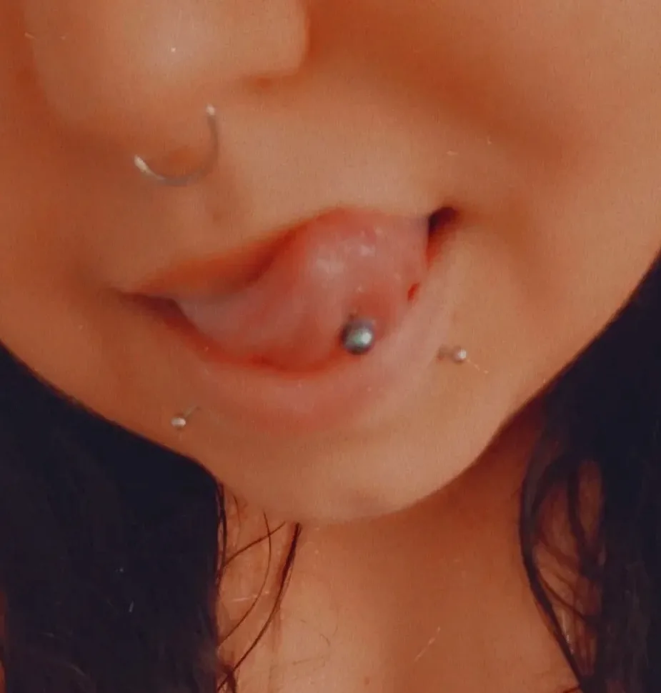 Noa, 30 años