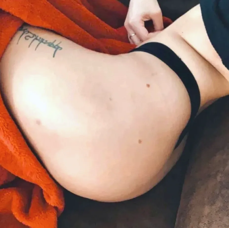 Silvia, 30 años